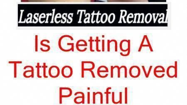 Tattoo Removal – What You Need After A Tattoo Removal Procedure