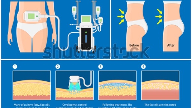 The Chilling Secret to a Slimmer You: Unveiling the Power of CoolSculpting!