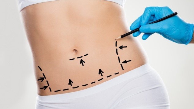 The Ultimate Guide to Achieving a Flat and Toned Tummy with a Tummy Tuck